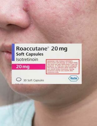 que-vaut-roaccutane-traitement-acnee