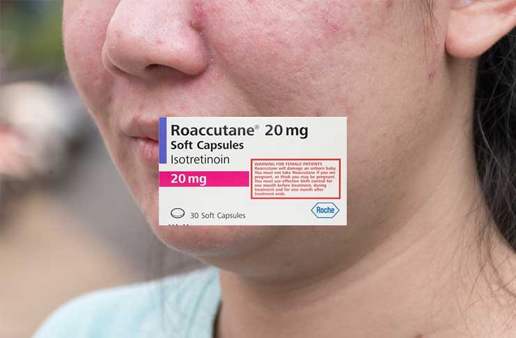 que-vaut-roaccutane-traitement-acnee